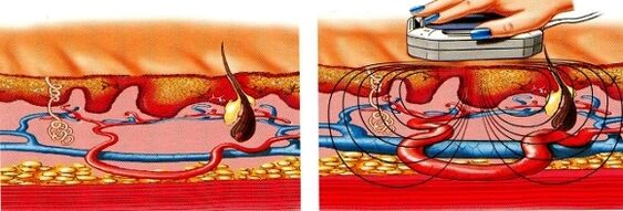 quando le tue gambe diventano insensibili