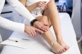 Regole e metodi per il trattamento delle vene varicose sulle gambe